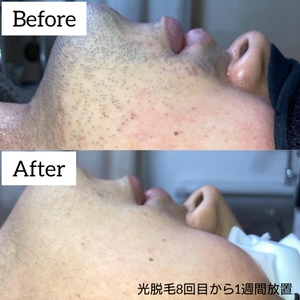 1jaujS3ZZxvNwtEbFdYO.jpg?w=940&h=940