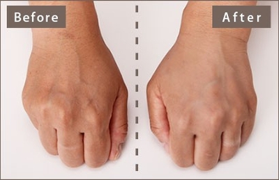 2kLlsxJEEOBPhlveqbbC.jpg?w=940&h=940