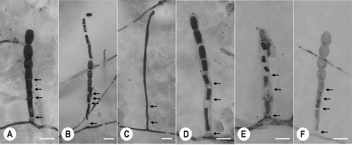 図1 農薬を処理されたメロンうどんこ病菌の単一菌叢内で観察された、正常(A)および異常な(B~F)分生子柄の形態。農薬処理後3日目に生体染色し、光学顕微鏡で観察した。
