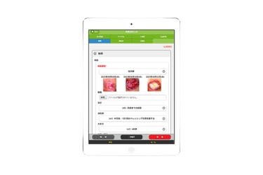 インフォファームが訪問業務アプリ 『Medicare』に褥瘡管理機能を追加搭載！ ～2023年10月リリース～