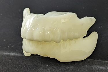 インフルエンザの季節、ドライマウスで感染のリスクも上がる！ 歯がないと口が渇きやすく寝る時専用入れ歯の製作数が3倍に増加！