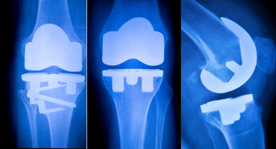 3bqYD0CBt1N0sbNoILU5.png?w=940&h=940