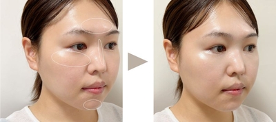 49coq216pMbUnHd4wnFP.jpg?w=940&h=940