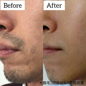 4k1hxuLIF8nutYnvVRQc.jpg?w=940&h=940