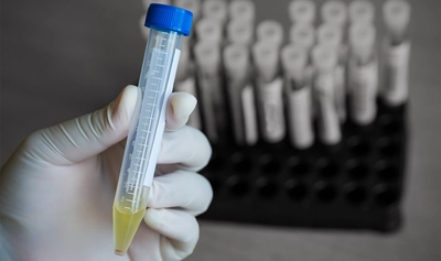 検査時間の短縮を実現。医誠会国際総合病院が院内検査体制を強化