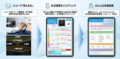 生活習慣超音波評価「お腹ソムリエ」®