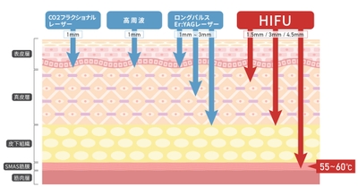 60FfBF1tfBisGv3Ox2OD.jpg?w=940&h=940