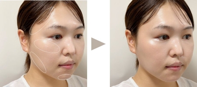 6MEw6kOOTZ7BinGaRv4f.jpg?w=940&h=940