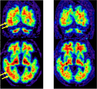 7S7d4Dt5Jof7v1ilI3pF.png?w=940&h=940