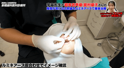 「声」を仕事にする宮村優子さんだからこそ、口元への意識も