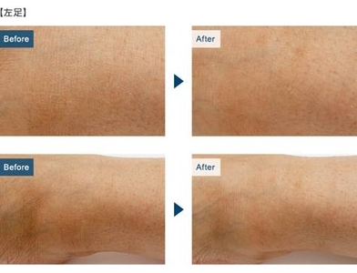 8OdTBwgjfTnS90oFJo66.jpg?w=940&h=940