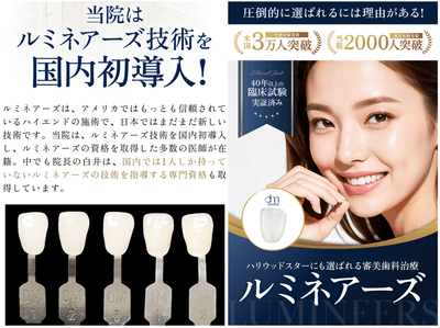 ハリウッドスマイルの白さ「ルミネアーズ」