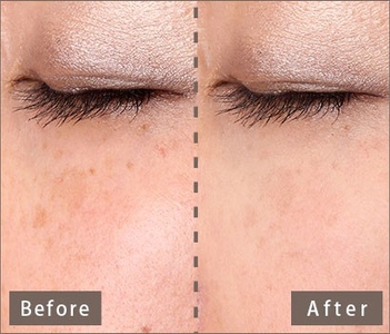 8jOzpojBvj1plIP5BSjq.jpg?w=940&h=940