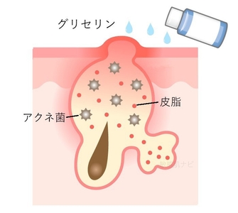 8qvTw2PP5t56fll80UNx.jpg?w=940&h=940