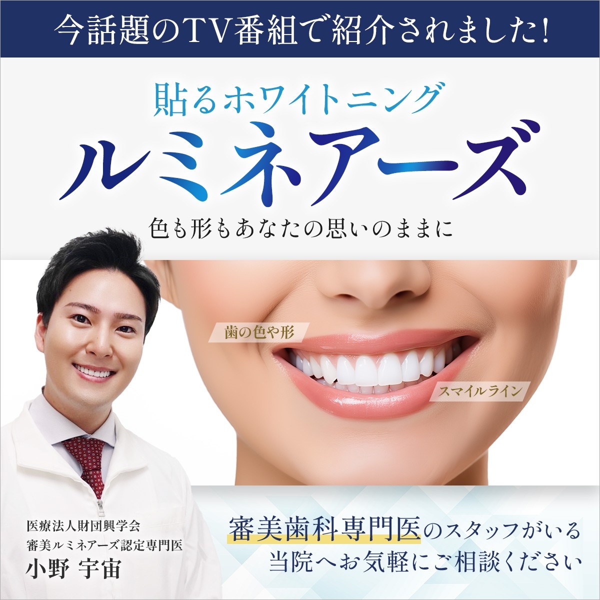 ルミネーズ(貼るホワイトニング)