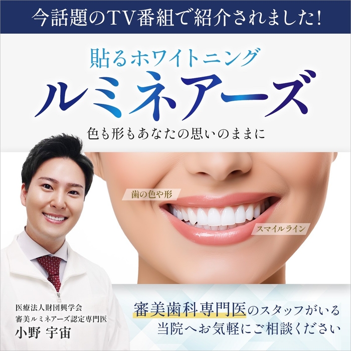 ルミネーズ(貼るホワイトニング)