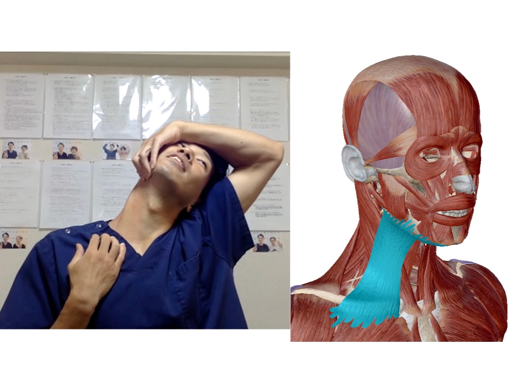 (セミナーの様子:首のストレッチ/広頚筋)