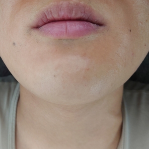 ABqXQ44CpFFMs9YbSfsg.jpg?w=940&h=940