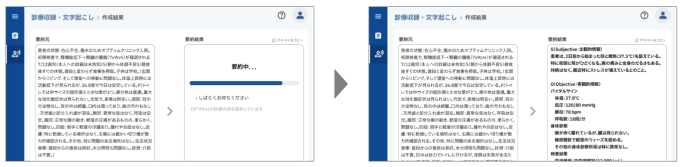 医師向け|カルテの作成支援(2025年春~夏 リリース予定)