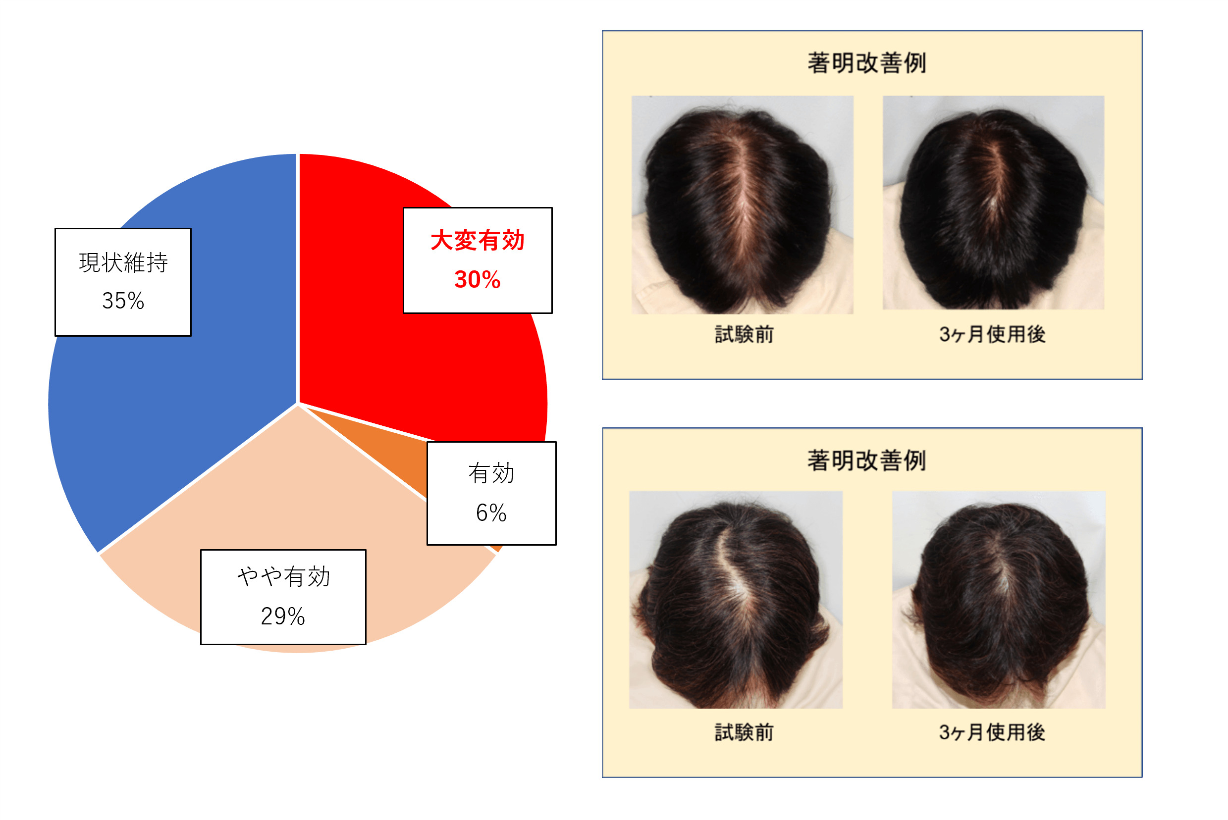 図3:週に1回の冷却刺激により65%のヒトに育毛効果を確認