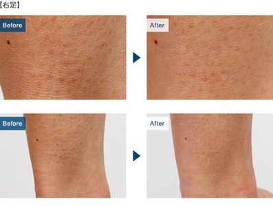 AzRUz8ceKw5C0clEQzGR.jpg?w=940&h=940