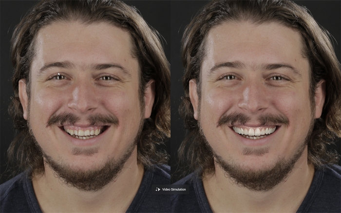 ビフォー＆アフター