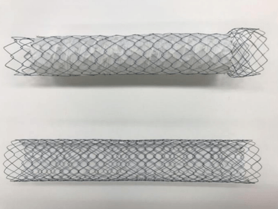 今回の多施設無作為化比較試験で使用した2種類のステント　上：胃十二指腸用カバー付きステント、下：胃十二指腸用カバーなしステント