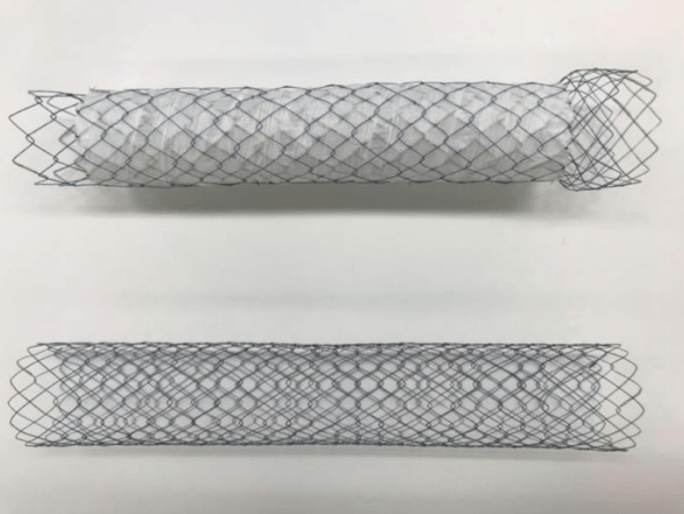 今回の多施設無作為化比較試験で使用した2種類のステント 上:胃十二指腸用カバー付きステント、下:胃十二指腸用カバーなしステント