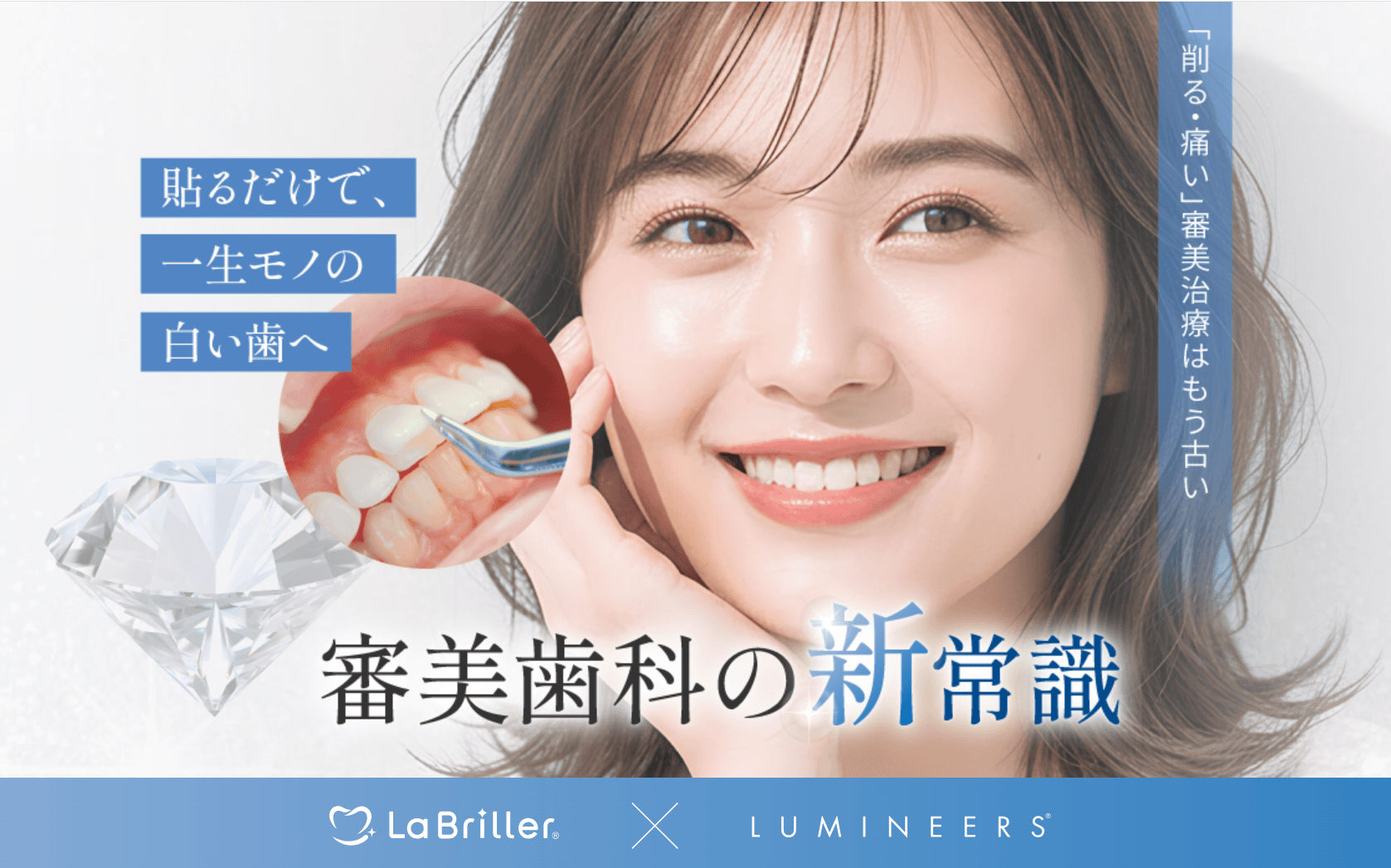 審美歯科治療「ルミネアーズ」に極薄ジルコニアベニア「ラブリエ」を導入 厚み0.3mmから最薄0.03mmへ、歯をまったく削らない審美治療の選択肢を拡大