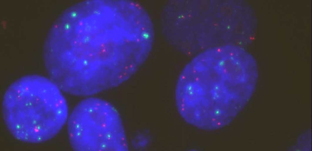 治療抵抗性獲得後の肺がん細胞モデル