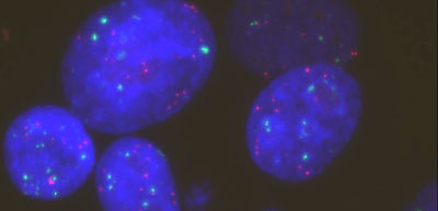 治療抵抗性獲得後の肺がん細胞モデル