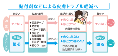 BrXtn72nOvKwSXgtUUnI.gif?w=940&h=940