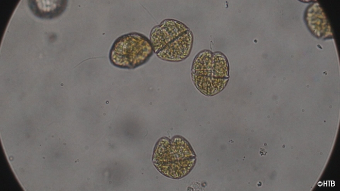 テレメンタリー「赤潮」赤潮を引き起こしたカレニア・セリフォルミス(C)HTB