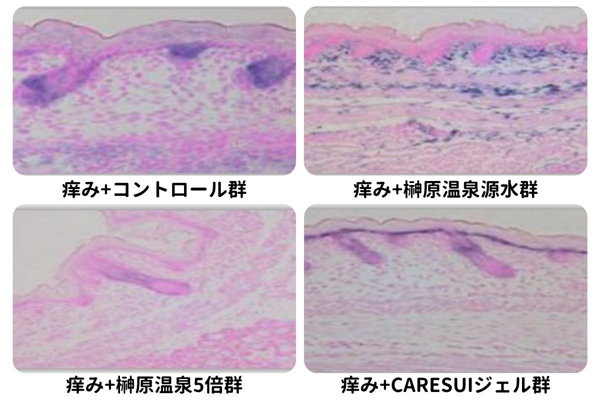 図1:痒みを発生させた皮膚のH&E染色の画像による分析