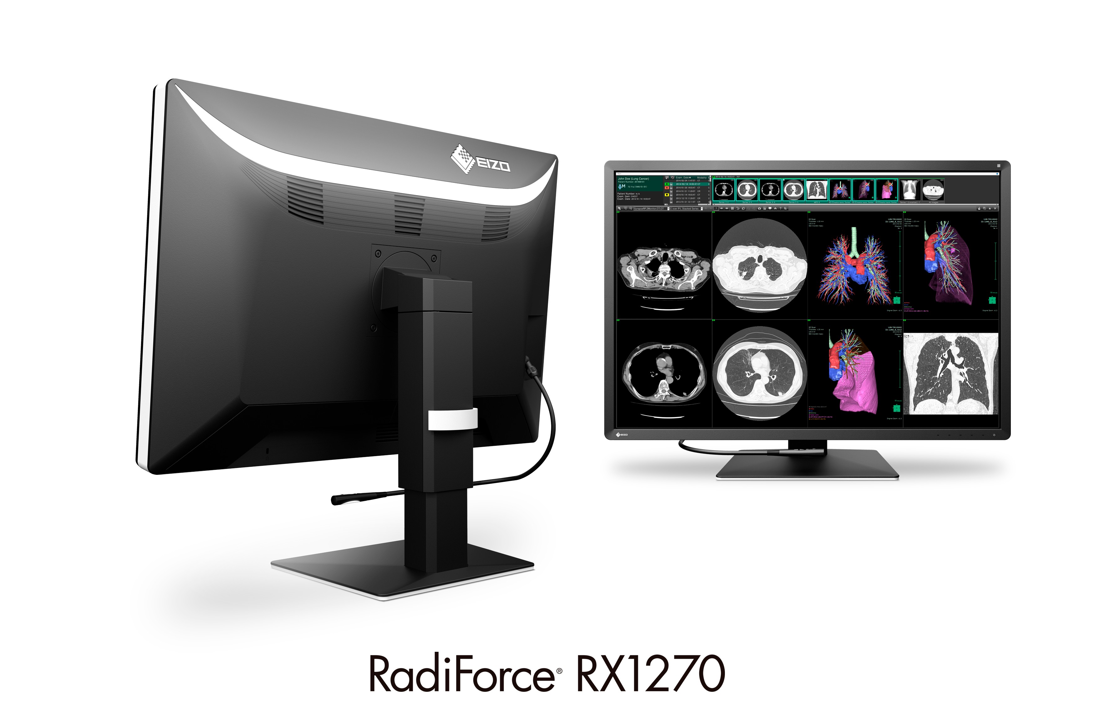 EIZO RadiForce RX350 医用画像表示用モニター ② EIZO初となる高解像度、12メガピクセル対応の 30.9型医用モニターを