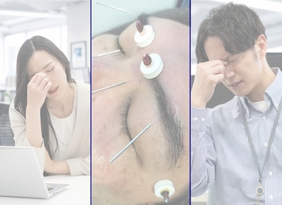 「頭専門」だからこそ見える、深刻な眼精疲労の現実。PC作業による蓄積した疲労を、鍼灸師の専門技術で根本からケア。