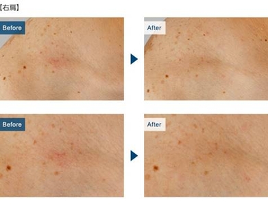 EM7EgdyLDmYYlITv5hxw.jpg?w=940&h=940