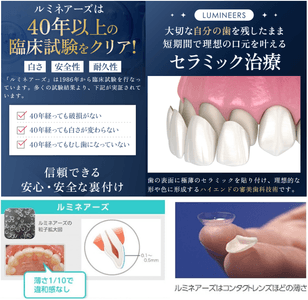 歯を全く削らない・痛みのない「ルミネアーズ」審美歯科治療