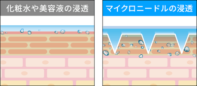 F8bpItimZWswsXi066Rj.png?w=940&h=940