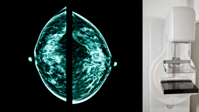 FaKIaNH1xO3H92SvzESa.png?w=940&h=940