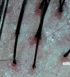 Fbfowu1mJnazmCoS6dL0.png?w=940&h=940