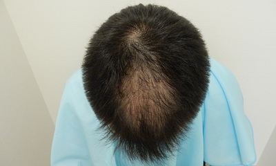 FfyMLZs5G5kkuLYBK3aX.jpg?w=940&h=940