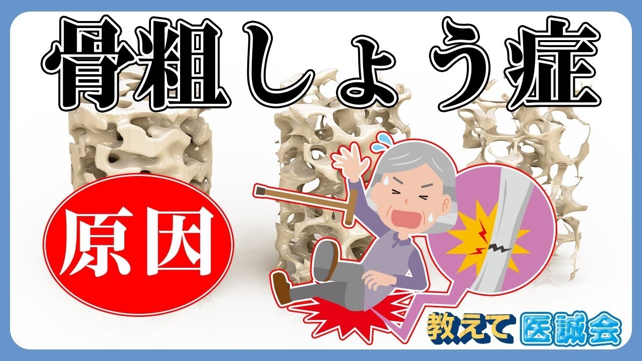 「教えて医誠会」新動画シリーズ公開 骨粗しょう症を3回にわたり解説!6月4日スタート