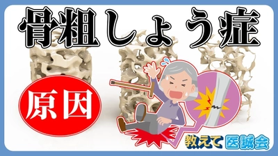 「教えて医誠会」新動画シリーズ公開　骨粗しょう症を3回にわたり解説！6月4日スタート