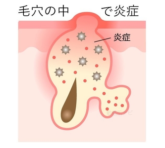 G3CZgTHFRLHHrMlEQMBw.jpg?w=940&h=940