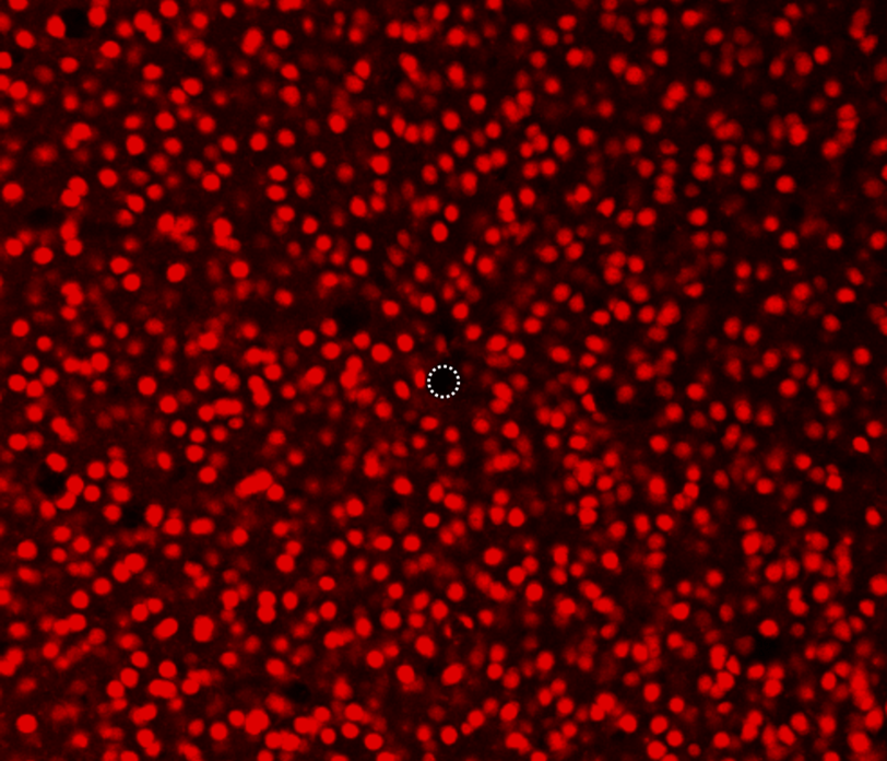 図:直径5 µmマイクロニードル電極周辺の神経細胞(ニューロン)の観察