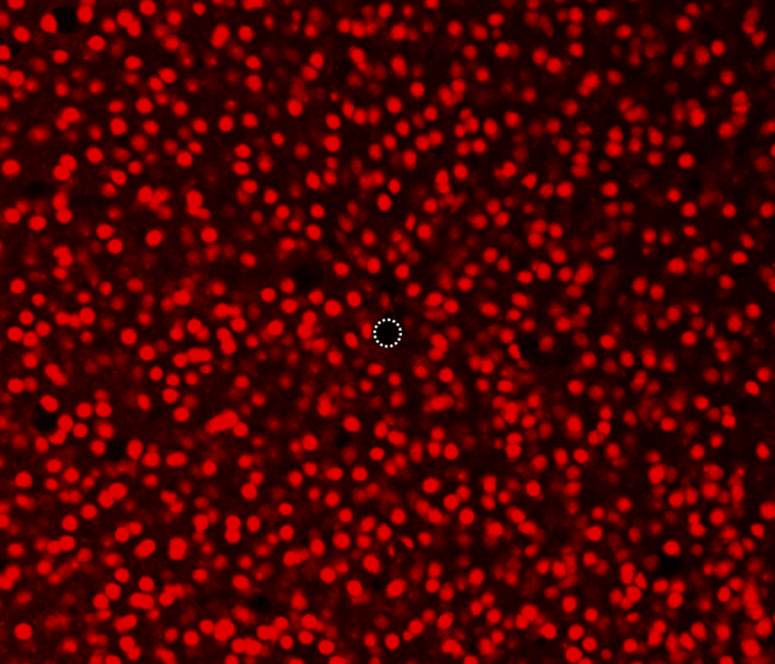 図:直径5 µmマイクロニードル電極周辺の神経細胞(ニューロン)の観察