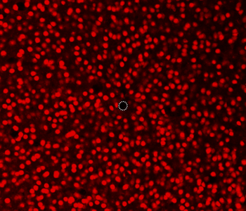 図：直径5 µmマイクロニードル電極周辺の神経細胞（ニューロン）の観察