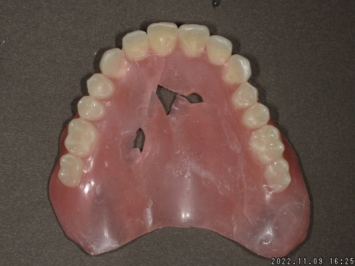 4. T様-2 部品を合わせてみたものの。。。欠けがある部分は修復します
