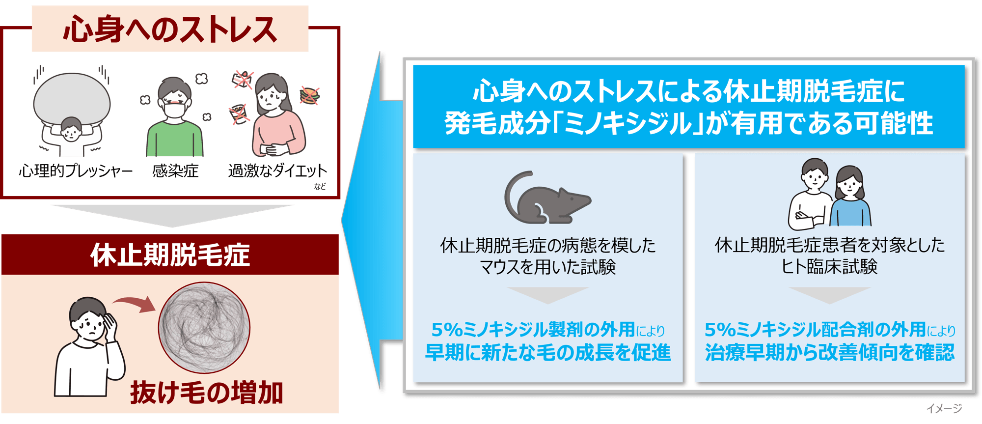 【新知見】心身へのストレスによる抜け毛の増加（休止期脱毛症）に
発毛成分「ミノキシジル」が有用な可能性を見出す
